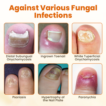 NATRAVOR® FungiBee Advanced Nail Repair Spray