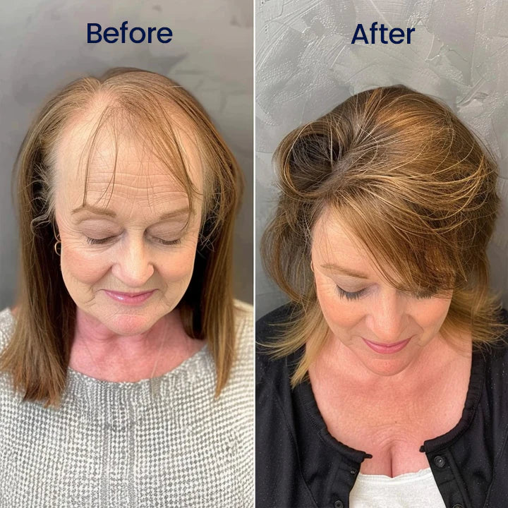 NATRAVOR® Maximum Strength 5% Minoxidil Fast-Action Hair Growth Serum