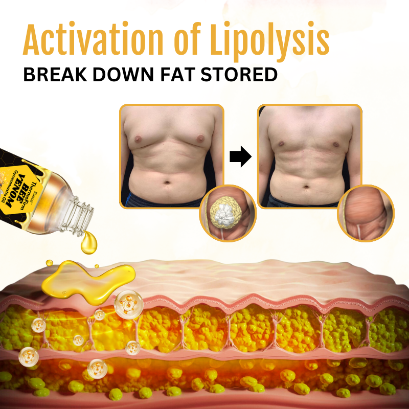 ThermoFirm Bee Venom Gynecomastia Oil