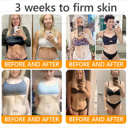 Made and Shipped from USA ✨Bee venom Comprehensive Cream 🔥 LAST DAY 80% OFF 💎💎