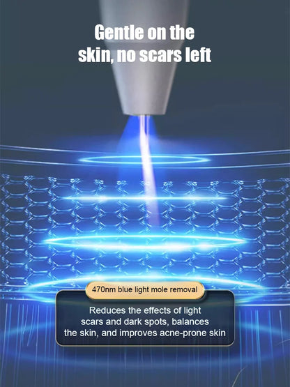 Laser painless wart removal pen--Gentle laser technology for flawless skin—no needles, no scars!