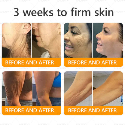 Made and Shipped from USA ✨Bee venom Comprehensive Cream 🔥 LAST DAY 80% OFF 💎💎