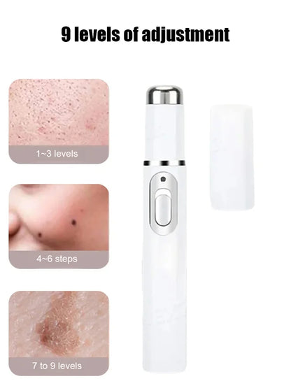 Laser painless wart removal pen--Gentle laser technology for flawless skin—no needles, no scars!