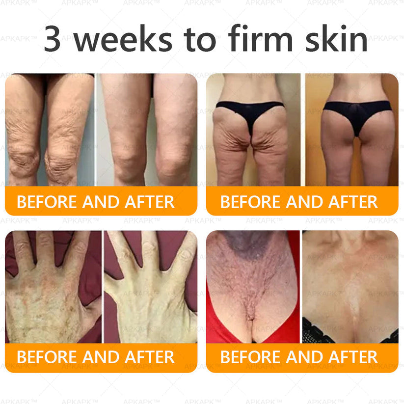 Made and Shipped from USA ✨Bee venom Comprehensive Cream 🔥 LAST DAY 80% OFF 💎💎