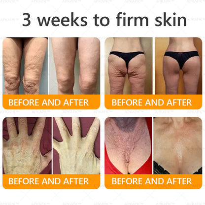 Made and Shipped from USA ✨Bee venom Comprehensive Cream 🔥 LAST DAY 80% OFF 💎💎