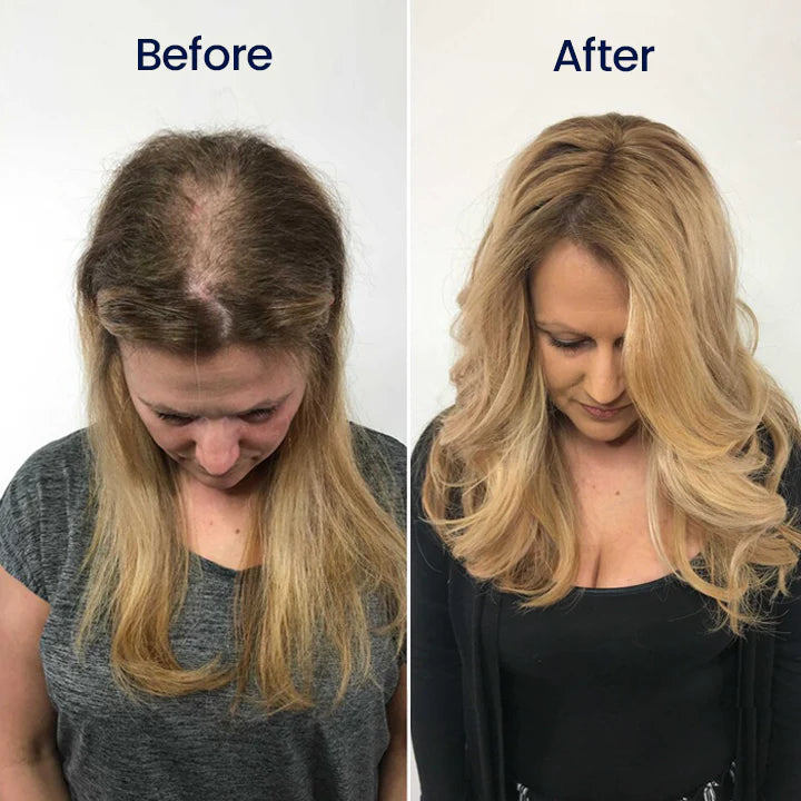 NATRAVOR® Maximum Strength 5% Minoxidil Fast-Action Hair Growth Serum