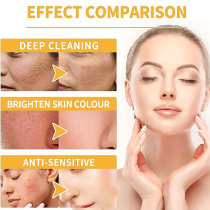 🎄Christmas Sale 58% OFF🌟🧴Gentle Exfoliating Moisturizing Body Spray- Makes Skin Soft & 💝 Buy 2 Get 1 Free